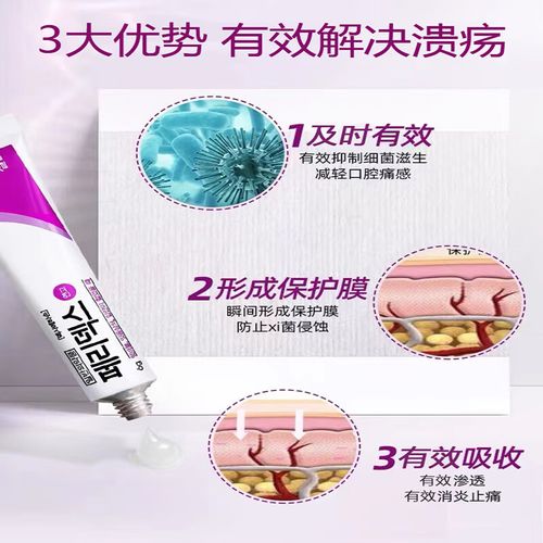 绿十字口腔溃疡膏效果如何?