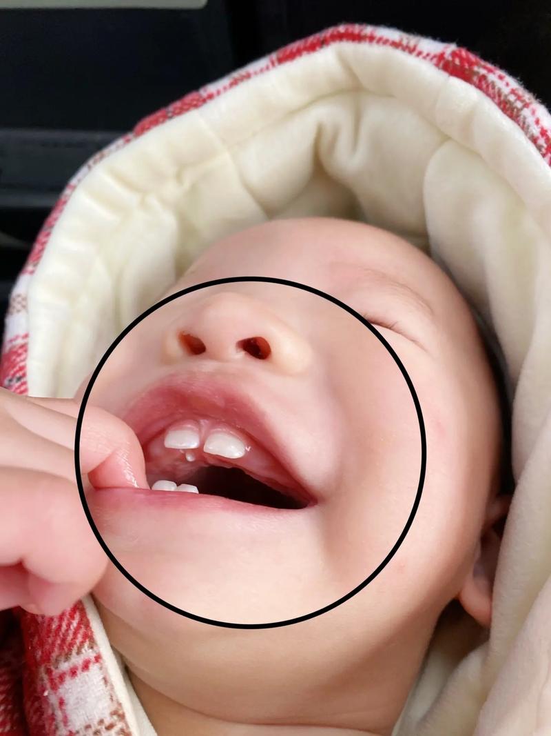 口腔最后面的牙是智齿还是其他问题?