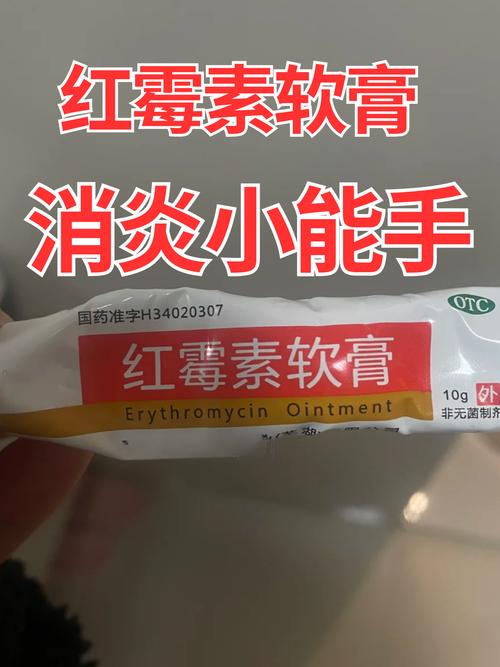 皮肤过敏能用红霉素吗
