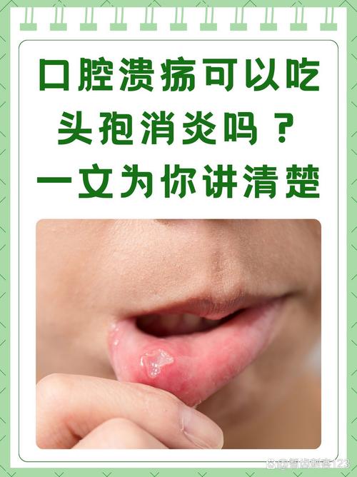 嗓子口腔溃疡了怎么办?