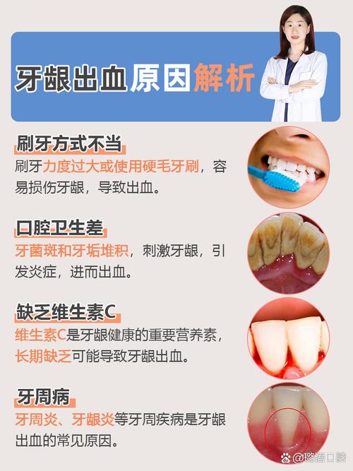 口腔一直出血,是牙龈炎还是全身疾病?