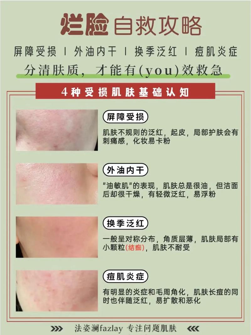 脸部皮肤泛红怎么改善?