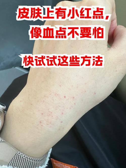 皮肤红点内有血是何原因?