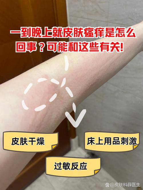 皮肤一到晚上奇痒无比