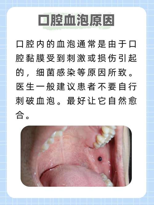 口腔起泡是啥原因?