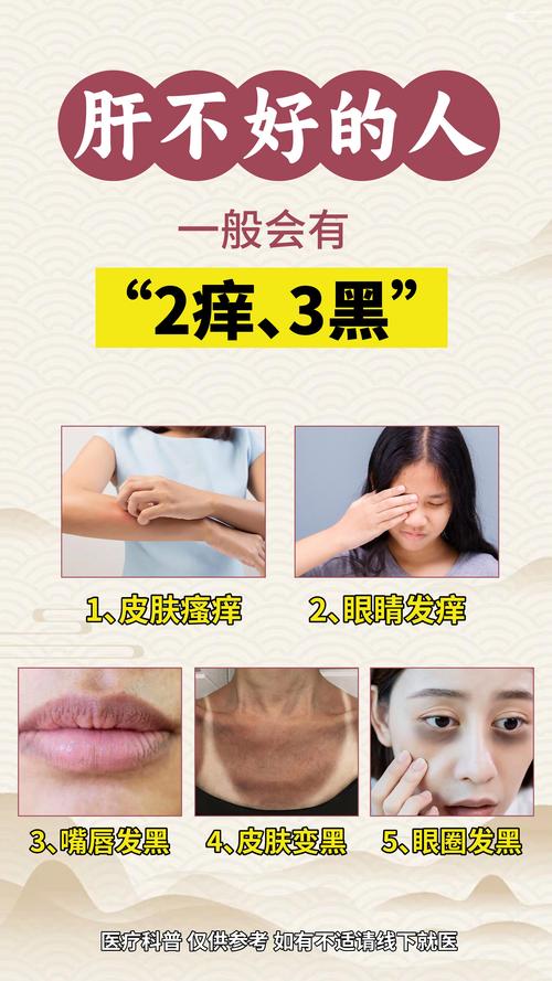 肝不好对皮肤有影响吗