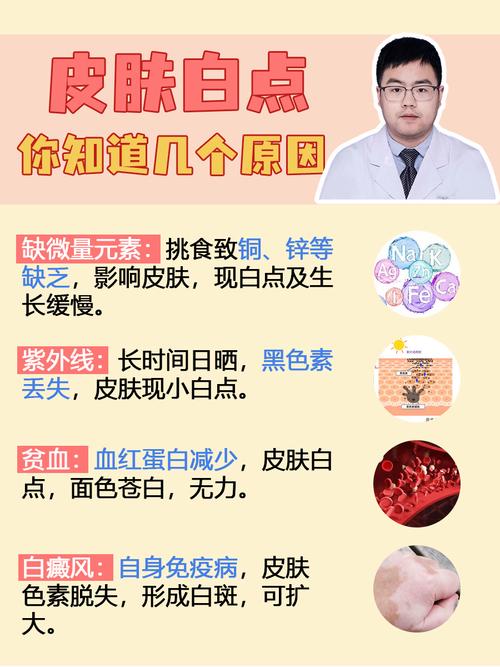 皮肤白点病是怎么回事