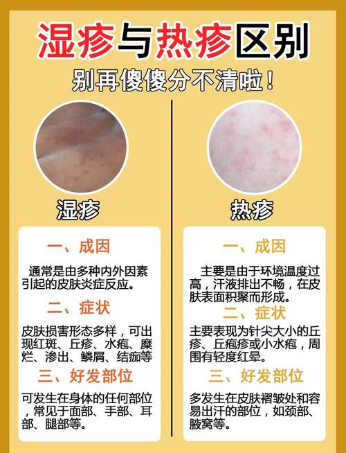 皮肤排毒和过敏到底如何区分？