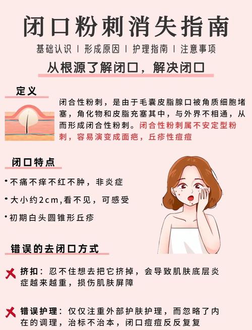 皮肤闭口是怎么形成的?