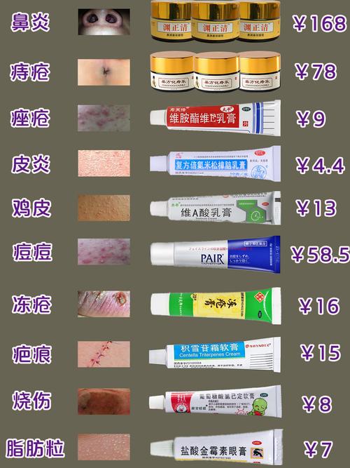 皮肤止痒药膏有哪些?如何选对?