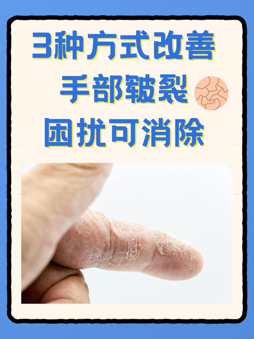 强碱腐蚀皮肤如何紧急处理?