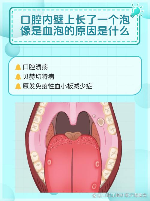 口腔起水泡是上火还是疾病?