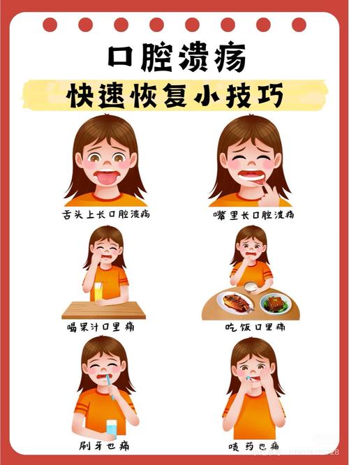 口腔溃疡反反复复怎么办?