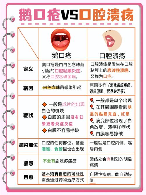 口腔溃疡该挂什么科室?