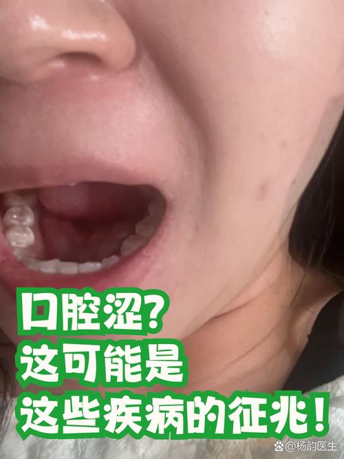 口腔干涩是何因?