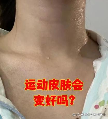 运动真能改善肤质?皮肤变好的秘诀是什么?