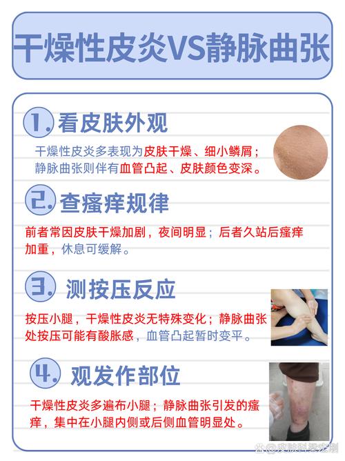 强酸灼伤皮肤,紧急处理该怎么做?