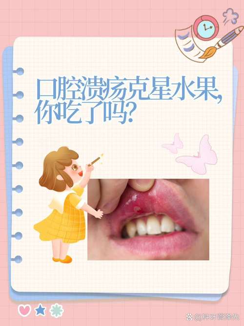 口腔溃疡能吃无花果吗?