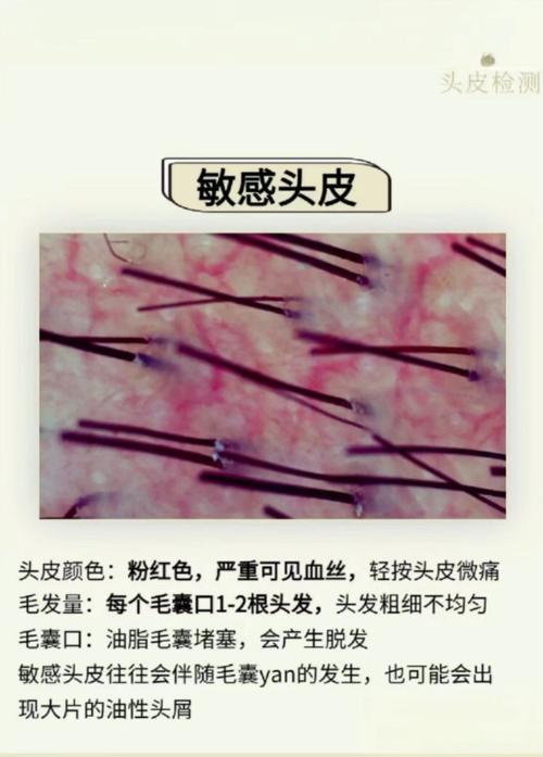 皮肤变薄后,能真正恢复如初吗?