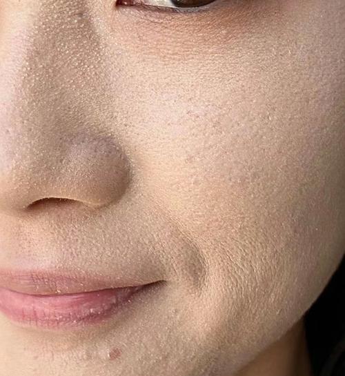 皮肤缺水会导致毛孔变大吗?