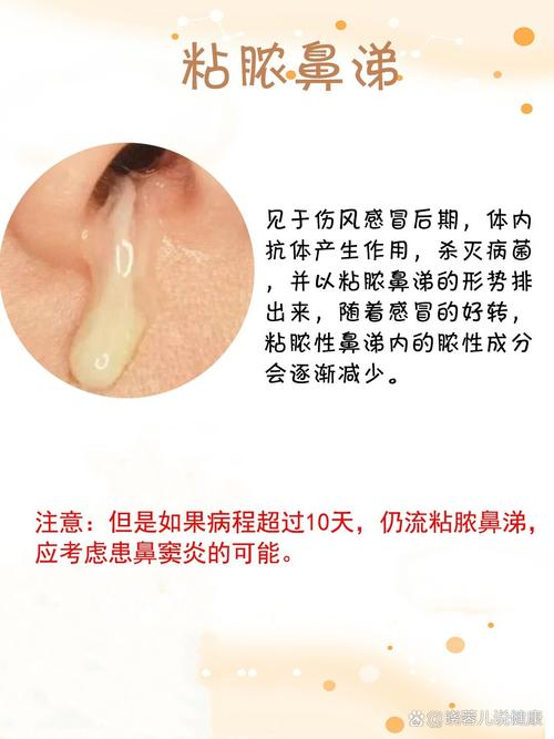 鼻涕倒流口腔恶臭,咋办?