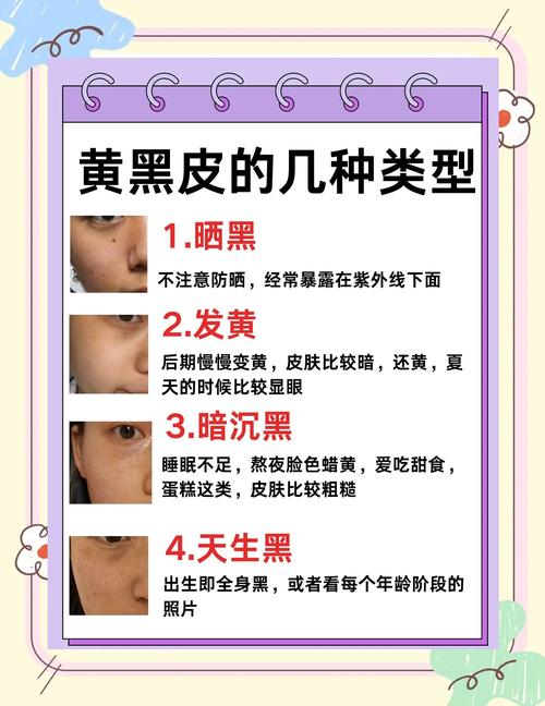 皮肤又黄黑,是身体哪里出问题了吗?