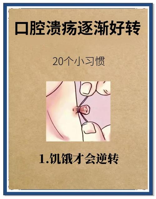 口腔溃疡为何总反复长?