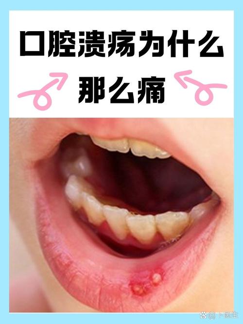 口腔张开痛,是哪些原因导致的?