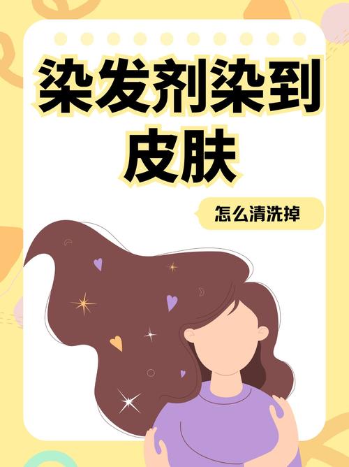 皮肤沾染发剂了,怎么快速去除?