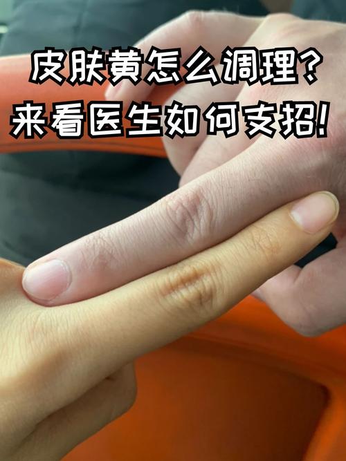 皮肤被烟熏黄了怎么办