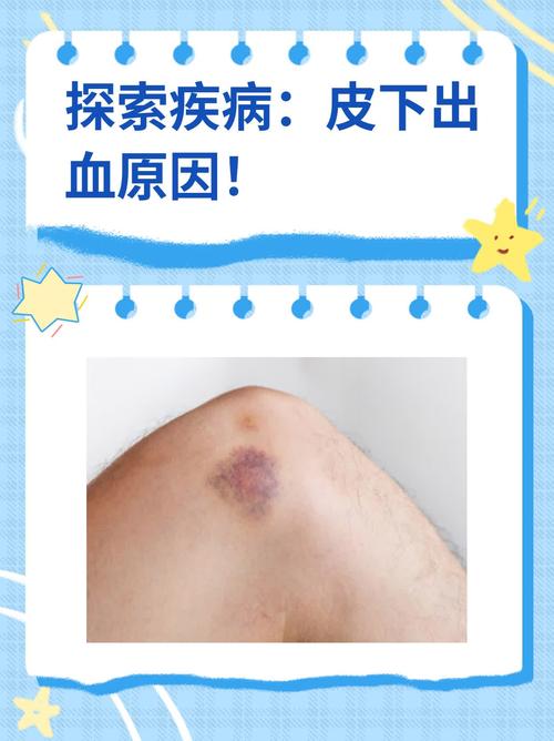 皮肤毛孔出血是何病征兆?