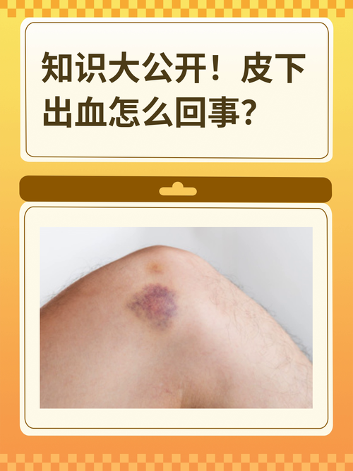 皮肤毛孔出血是何病征兆?