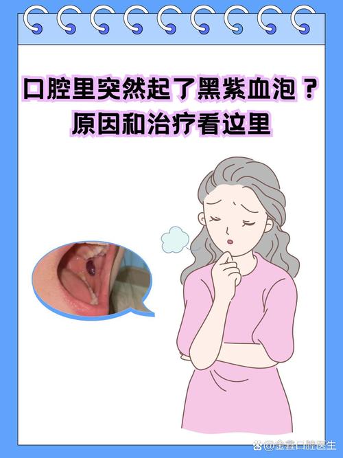 口腔内壁增厚是何原因?