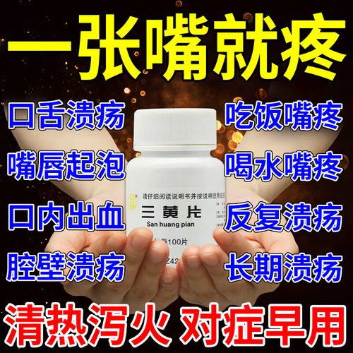 口腔溃疡哪种药最好?