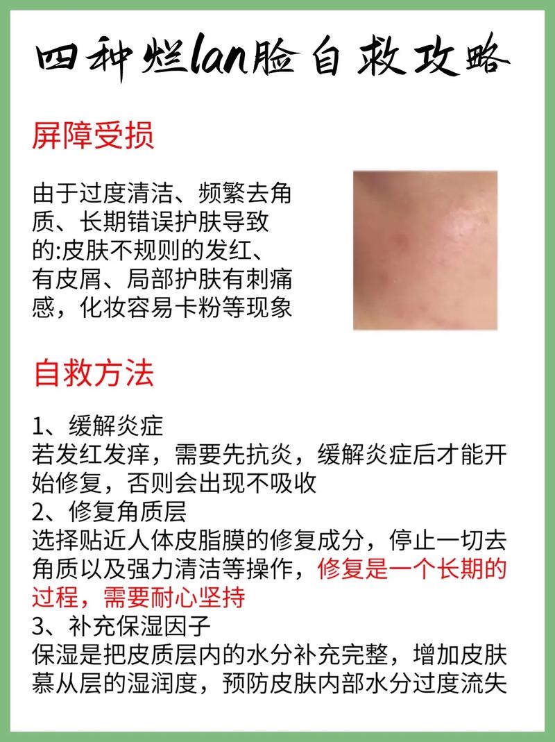 脸上皮肤泛红,怎么修复才有效?