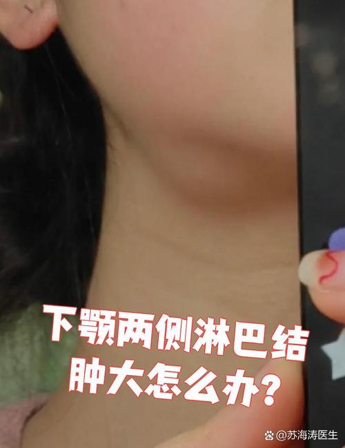 口腔淋巴结具体位置在哪里?