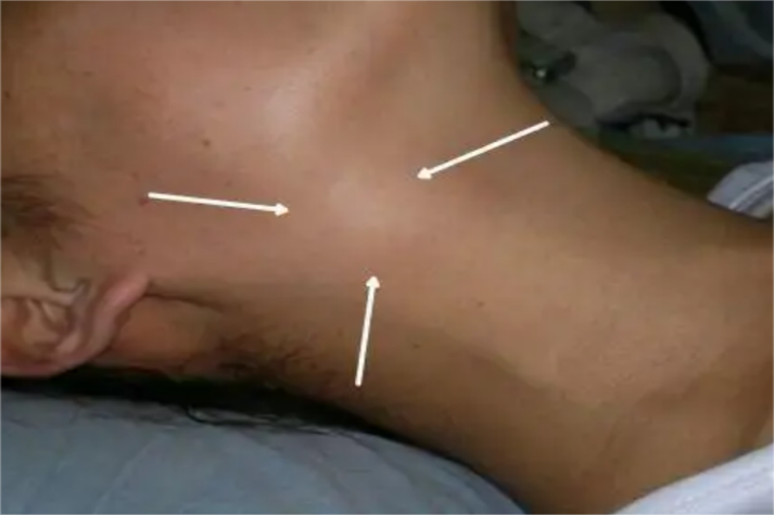 口腔淋巴结具体位置在哪里?