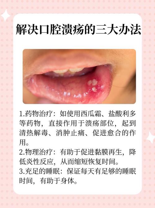 长期口腔溃疡总反复,到底怎么治才好?