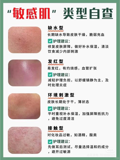 如何判断自己是不是敏感性皮肤?