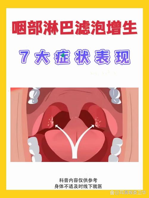 口腔滤泡因何而起?