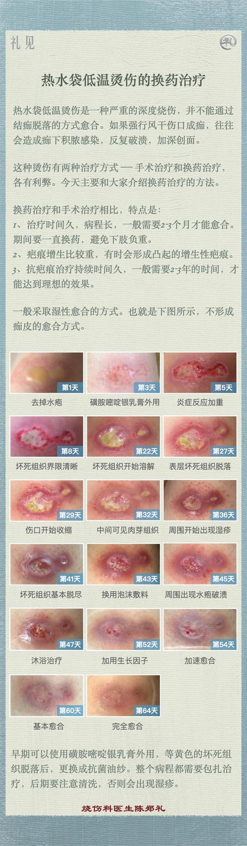 土霉素碾碎治皮肤病安全有效吗?