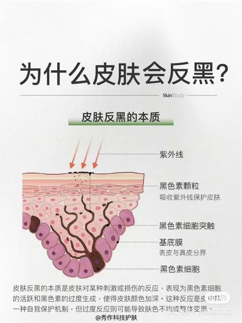 熬夜真的会让皮肤变黑吗?