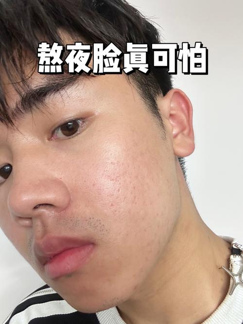 熬夜真的会让皮肤变黑吗?