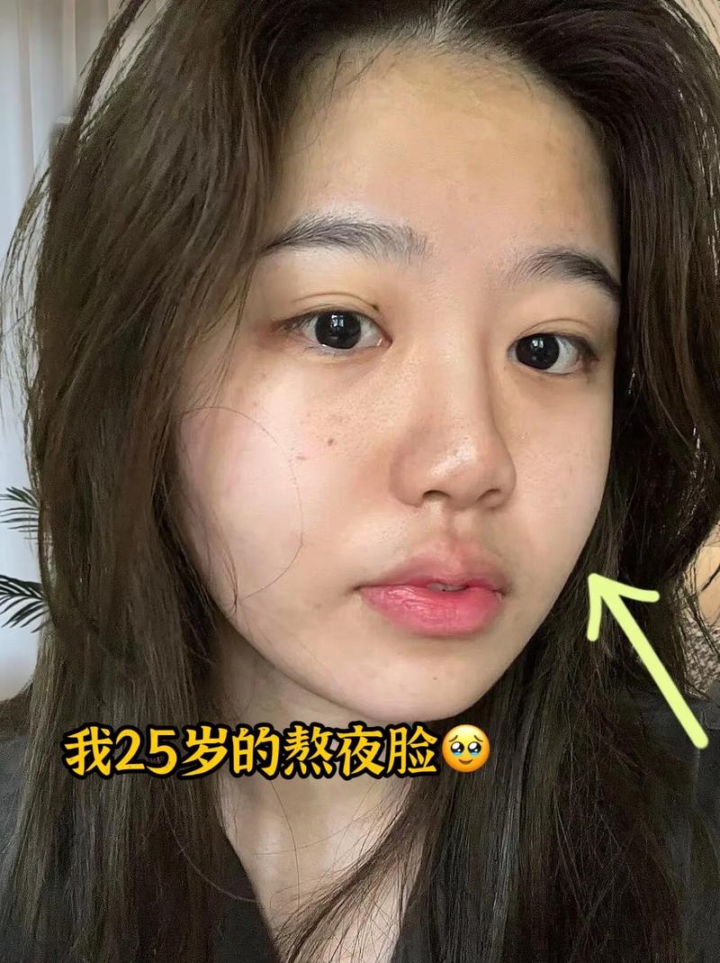 熬夜真的会让皮肤变黑吗?