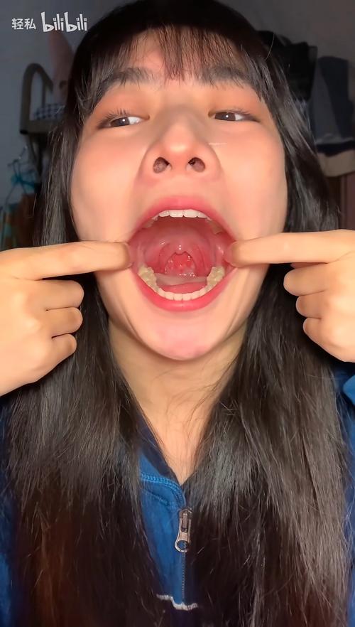 妹子口腔咽喉检查视频为何拍?