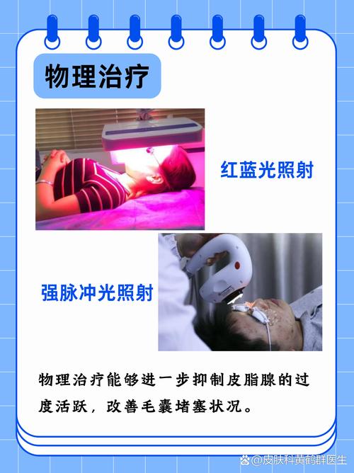 皮肤医院能治痘痘吗?