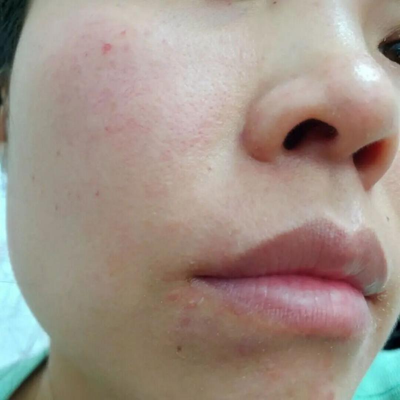 吹风伤皮肤?日常吹风藏哪些隐患?