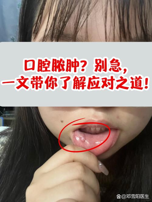 口腔脓肿究竟是如何引起的?