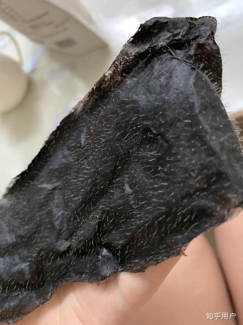 毛孔黑头是何物?如何清除?