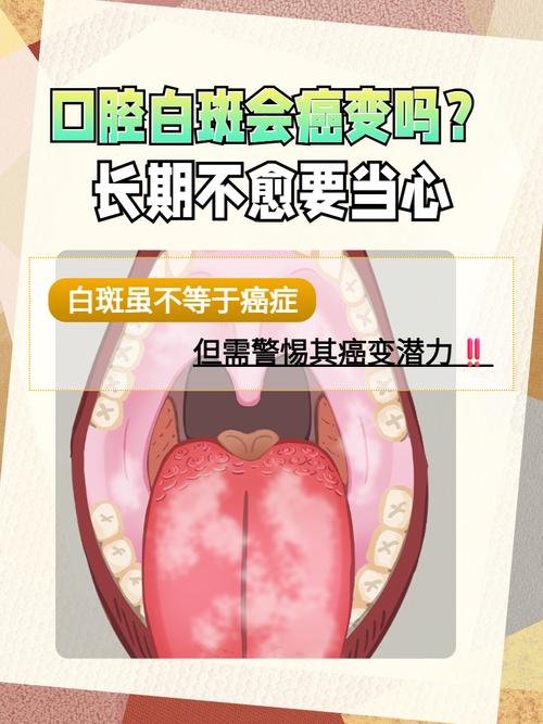 口腔内壁发白是何原因?